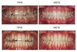 ORTHODONTIC SMILES CLINIC - ΤΣΟΥΡΑΚΗΣ Α. - ΠΑΠΑΜΑΝΟΥ Δ. Ορθοδοντικοί Βέροια