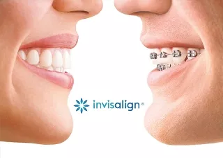 ORTHODONTIC SMILES CLINIC - ΤΣΟΥΡΑΚΗΣ Α. - ΠΑΠΑΜΑΝΟΥ Δ. Ορθοδοντικοί Βέροια