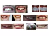 GIANNAKOPOULOU ANASTASSIA Orthodontists Korydallos