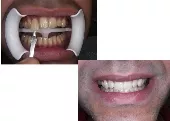 SMILE CREATIONS - ARVANITIDOU PANAGIOTA Dentists Oreokastro