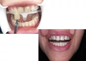 SMILE CREATIONS - ARVANITIDOU PANAGIOTA Dentists Oreokastro