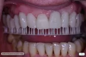 DENTAL 4ALL ΟΔΟΝΤΙΑΤΡΙΚΗ ΜΕΡΙΜΝΑ - ΤΖΩΡΑΣ Ε. ΒΑΣΙΛΕΙΟΣ Οδοντίατροι Αγρίνιο